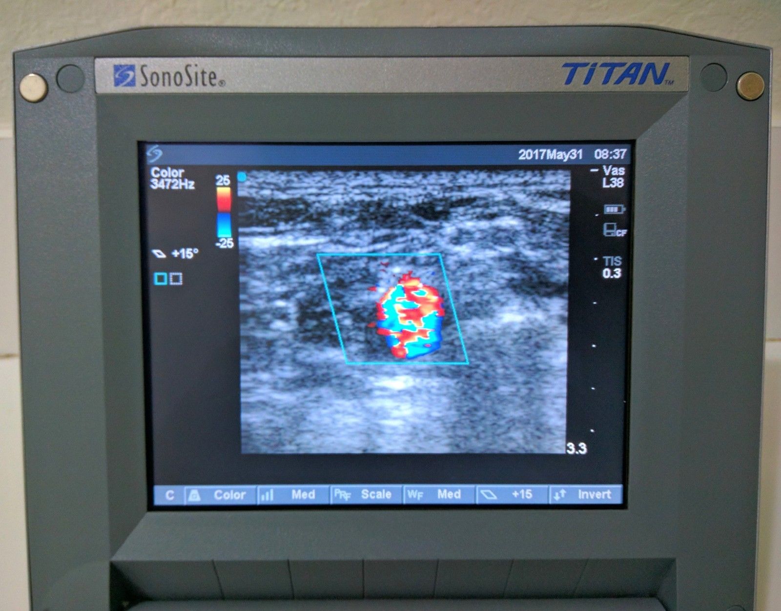 SONOSITE TITAN CV W/1 PROBE 1-L38 LINEAR TRANSDUCER PROBE DIAGNOSTIC ULTRASOUND MACHINES FOR SALE