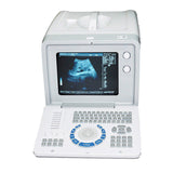 Image 3D Digital Portable Ultrasound Scanner Machine Convex +Transvaginal Probe 190891982193