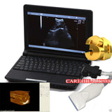 Full Digital 10" Color Laptop Ultrasound Scanner Machine 3D Linear Probe Tendon