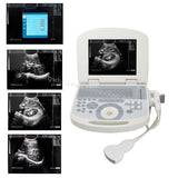 Laptop Ultrasound Machine Scanner Convex Probe 3D Software High Resolution Clear 190891045898