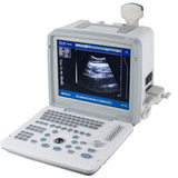 Full Digital Portable Ultrasound Scanner Machine Equip Transvaginal Linear Probe