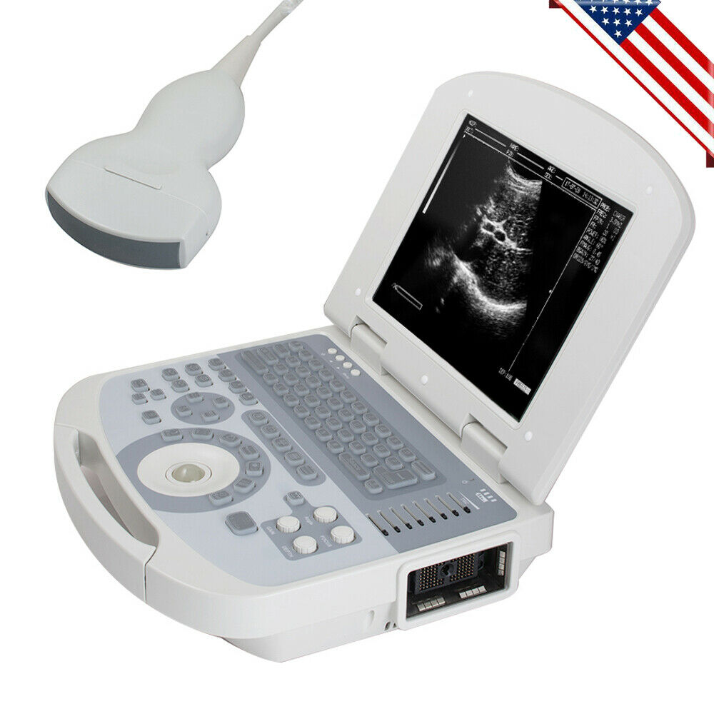 Digital Medical Ultrasound Scanner With 3.5MHZ Convex Probe 3D Image Pregnancy DIAGNOSTIC ULTRASOUND MACHINES FOR SALE