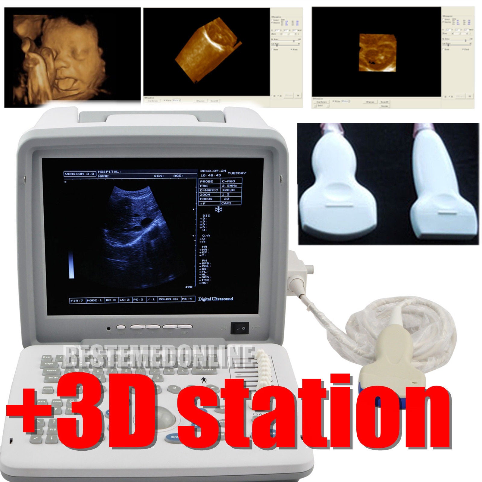 New SALE 39% Ultrasound Scanner Digital Machine + Convex &Linear 2 Probes + 3D 190891249302 DIAGNOSTIC ULTRASOUND MACHINES FOR SALE