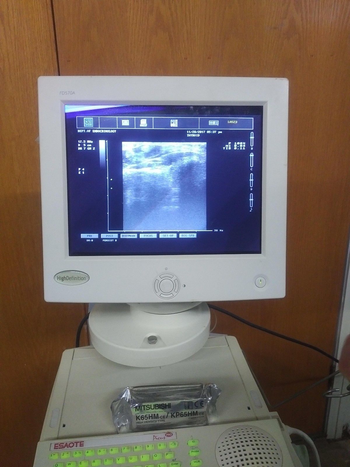 Esaote Picus Pro Ultrasound DIAGNOSTIC ULTRASOUND MACHINES FOR SALE