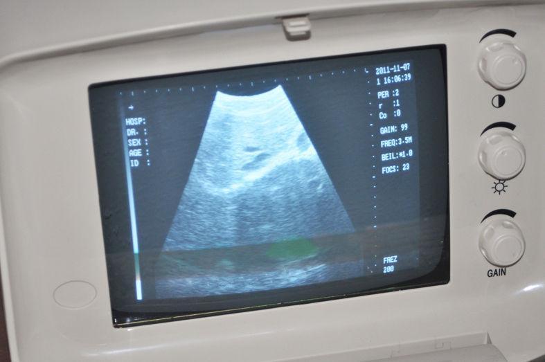 Medical Ultrasound Scanner Machine +7.5Mhz  Linear Probe +3D Software 3 Years w 190891866943 DIAGNOSTIC ULTRASOUND MACHINES FOR SALE