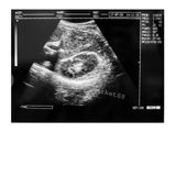 US Ultrasound Machine Laptop Ultrasound Machine Scanner Convex probe 3D Software 190891045898