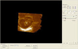Notebook Digital Ultrasound Scanner/Exam Machine  Convex + Linear 2 Probes 3D AA