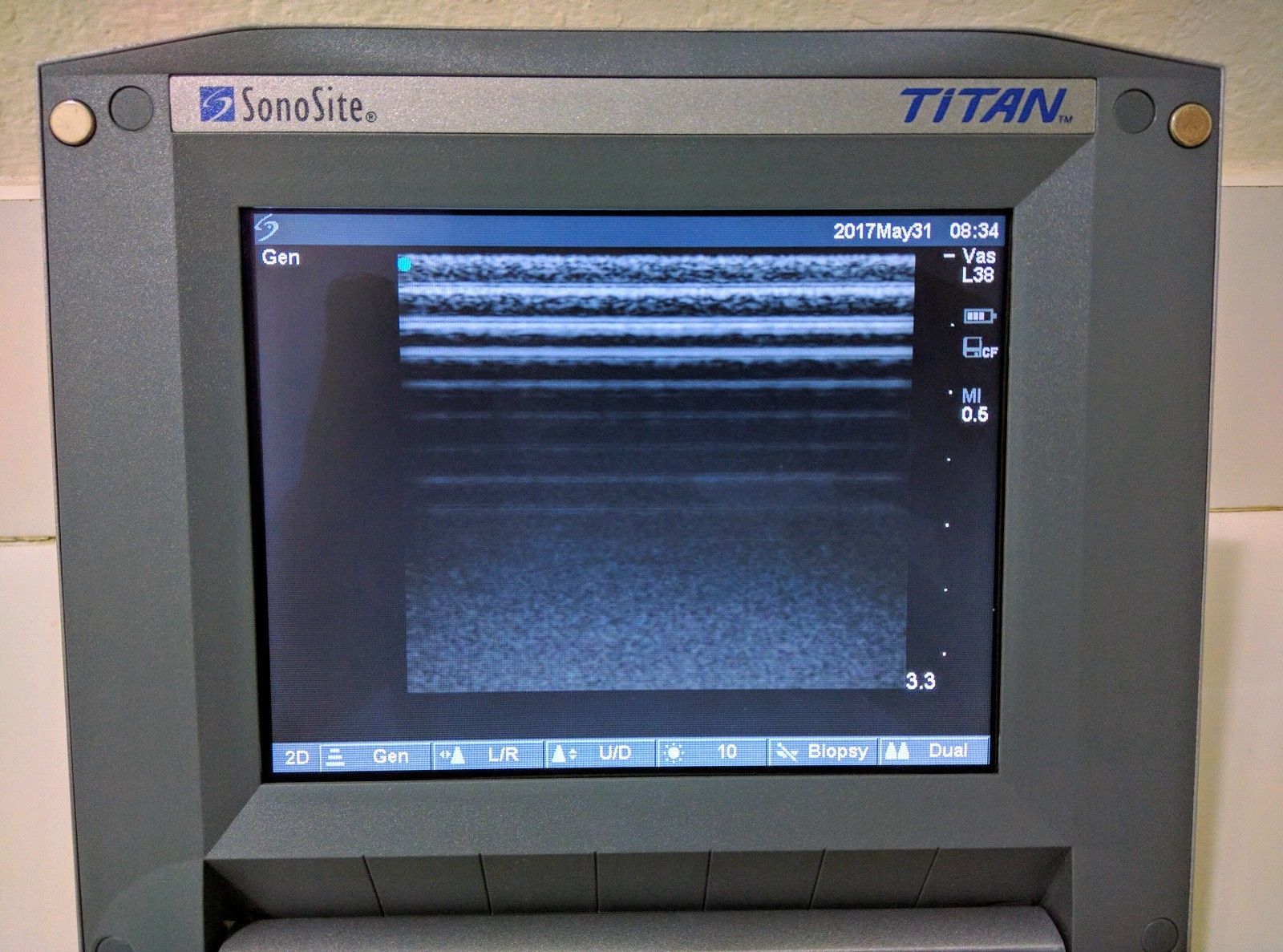 SONOSITE TITAN CV W/1 PROBE 1-L38 LINEAR TRANSDUCER PROBE DIAGNOSTIC ULTRASOUND MACHINES FOR SALE