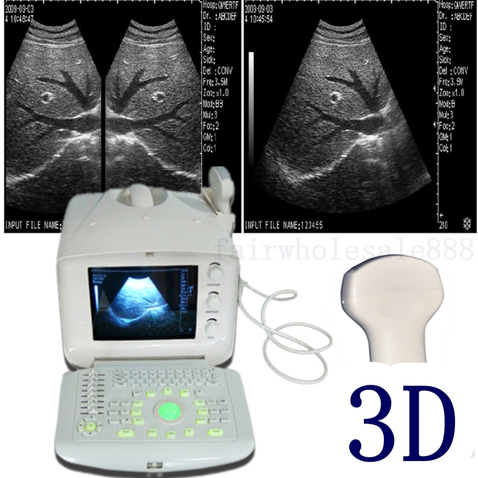 Portable Ultrasound Scanner w probe Convex+Micro convex heart Echo +3D software 190891057600 DIAGNOSTIC ULTRASOUND MACHINES FOR SALE