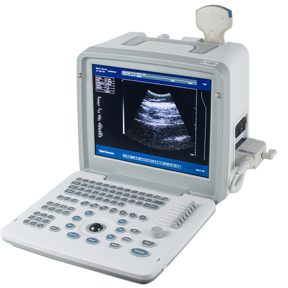 Portable Digital Ultrasound Scanner System Machine Convex +Transvaginal Probe+3D DIAGNOSTIC ULTRASOUND MACHINES FOR SALE