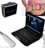 10.1'' Digital Laptop Ultrasound Scanner System W 5.0MHz Micro-convex Probe +bag