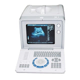 Portable 10 Inch Medical Digital LCD Ultrasound Scanner & Linear,convex Probe 190891976307