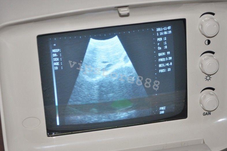 Digital Portable Ultrasound Scanner/Machine B ultrasound Micro-Convex Probe Top! DIAGNOSTIC ULTRASOUND MACHINES FOR SALE