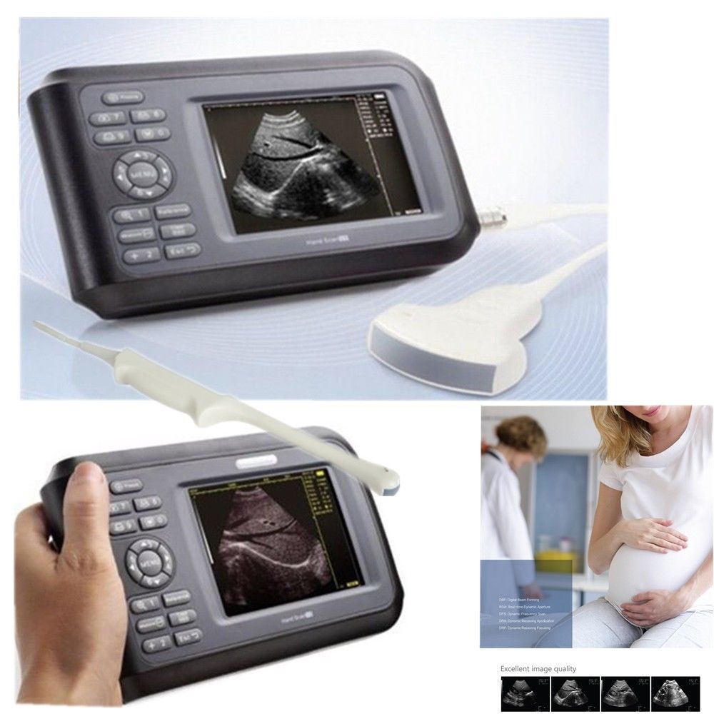 Handheld Ultrasound Scanner Machine Convex Probe+Pulse Oximeter + Battery + Case DIAGNOSTIC ULTRASOUND MACHINES FOR SALE