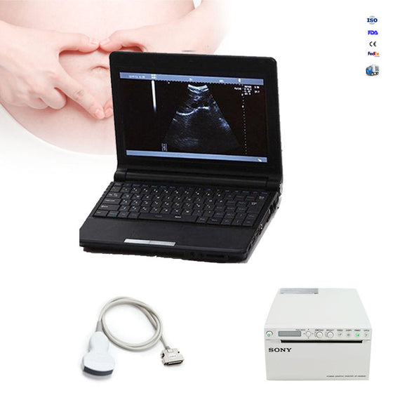 SONY Terminal Printer + Digital Ultrasound Scanner Notebook +Convex Probe +3D 190891974488