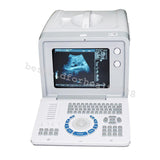 Digital Ultrasound Scanner+6.5MHz Transvaginal,3.5MHZ convex,7.5MHz Linear Probe 190891881052