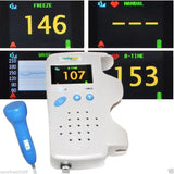 Digital Ultrasound Machine Scanner System+Convex + Linear Probe+Fetal Doppler CE 190891836625