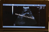 New 10.1'' Ultrasound Scanner With Convex+Linear+Transvaginal+Micro-convex Probe