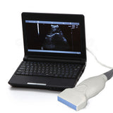 Digital Laptop Ultrasound Scanner machine system + 7.5MHZ Linear Probe Hospital
