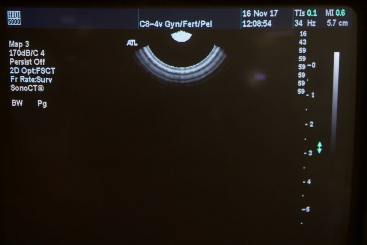 Philips ATL C8-4v Curved Array IVT Ultrasound Transducer HDI5000 4000-0409-04 DIAGNOSTIC ULTRASOUND MACHINES FOR SALE
