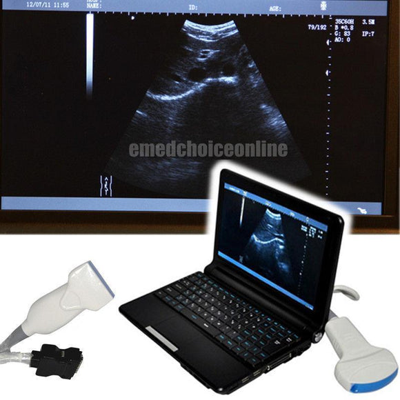 Laptop Digital Ultrasound Scanner Machine Convex Linear 2 Probes 3 D Scan Sale 190891492845