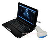 Full Digital Laptop Ultrasound Scanner Covex + Linear 2 Probes 9000F Sale CE 190891787651