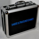 Laptop Machine ultrasound scanner Probe Convex/Linear/Transvaginal Case Battery 190891942104