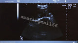 Veterinary vet Full Digital Laptop Ultrasound Scanner Micro-Convex Probe 3D Sale 190891712110