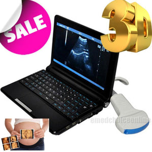 H-Quality Images Digital Ultrasound machine Scanner + Convex or Linear Probe +3D 190891920751