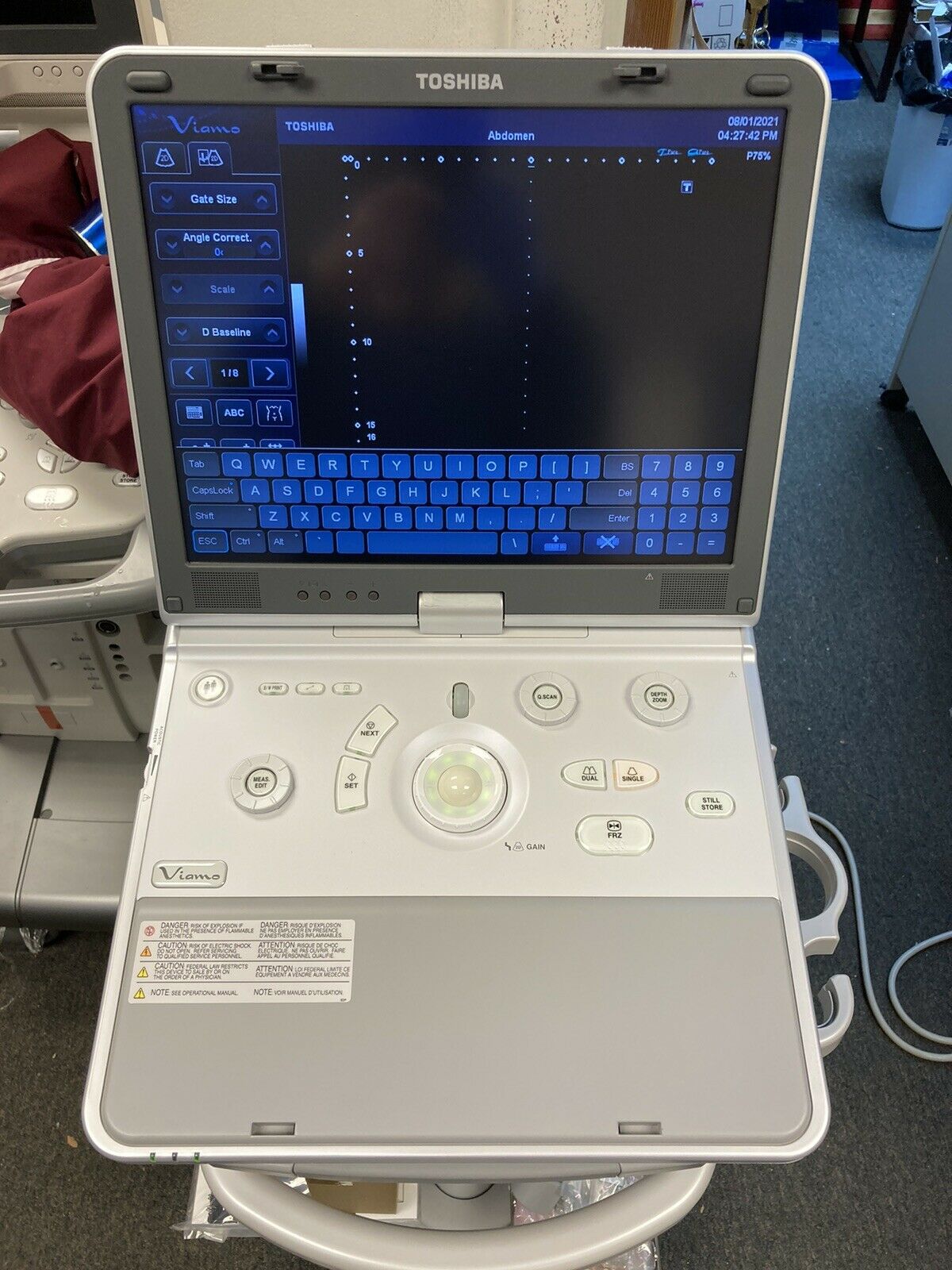 Toshiba Viamo Ultrasound System Model SSA-640A DIAGNOSTIC ULTRASOUND MACHINES FOR SALE