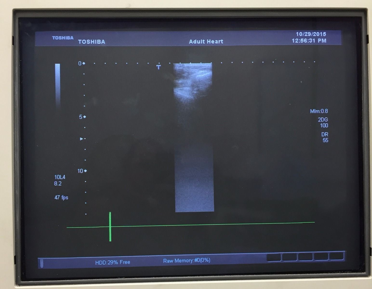 Toshiba Aplio PLT-604AT Ultrasound 6MHz Linear Transducer Probe Equipment DIAGNOSTIC ULTRASOUND MACHINES FOR SALE