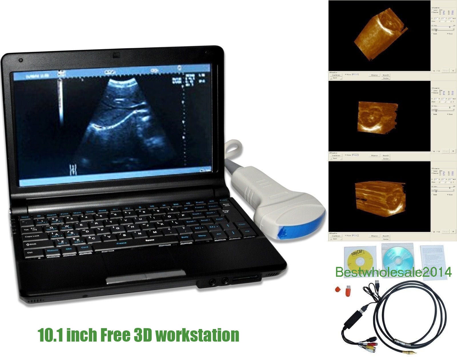 Laptop Ultrasound Scanner Diagnostic Ultrasonic Unit Convex linear 2Probe 3D AA 190891663399 DIAGNOSTIC ULTRASOUND MACHINES FOR SALE