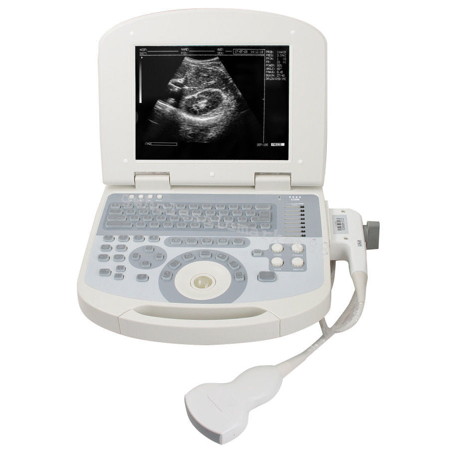 Portable Laptop Ultrasound Machine Scanner Convex Probe 3D Software Image 190891045898 DIAGNOSTIC ULTRASOUND MACHINES FOR SALE