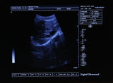 FAST 12'' Ultrasound Scanner Digital Machine+3D Image+Convex &Linear 2 Probes 190891919595
