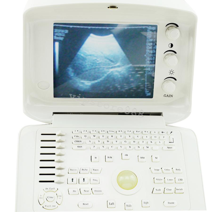 Digital Portable Ultrasound Scanner/Machine B ultrasound Micro-Convex Probe Top! DIAGNOSTIC ULTRASOUND MACHINES FOR SALE