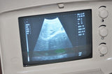 Digital Diagnose System Ultrasound Scanner Monitor Convex+Linear Probe 3D Image