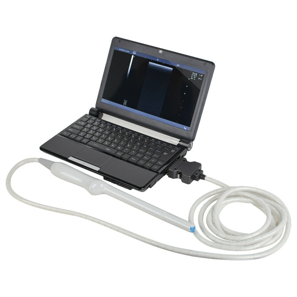 Digital Laptop Machine Ultrasound Scanner 7.5MHz Linear &Trans-vaginal Probe DIAGNOSTIC ULTRASOUND MACHINES FOR SALE