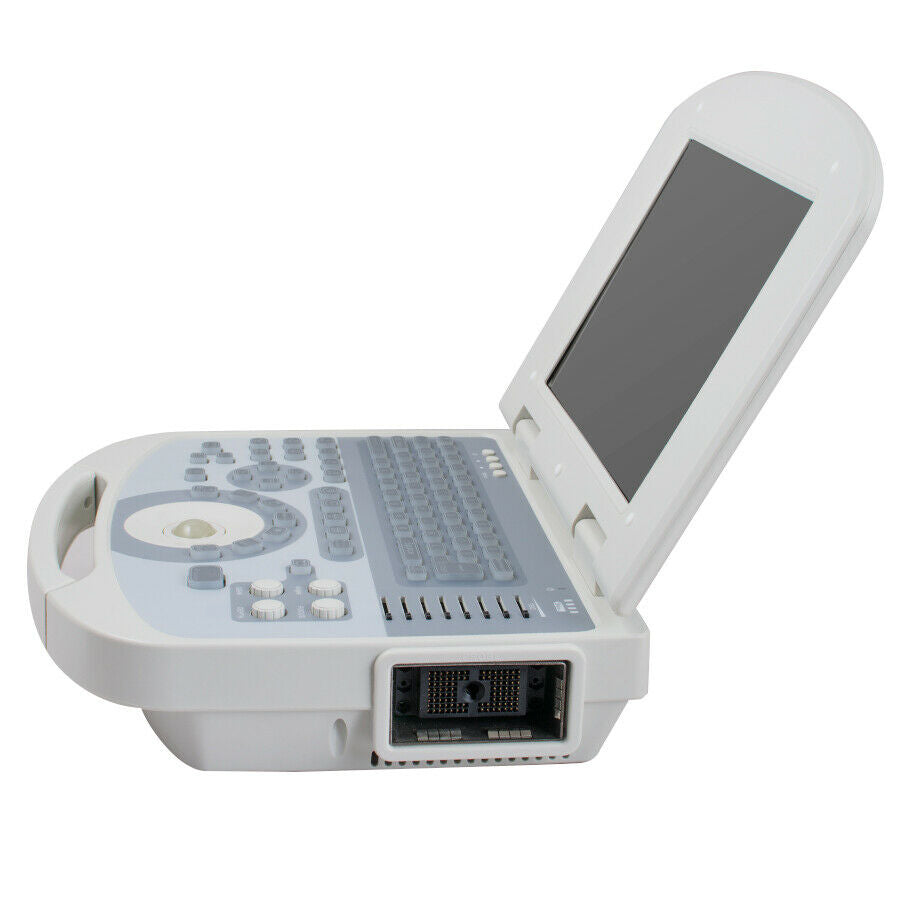 Portable 10.4in Full Digital Laptop Medical Ultrasound Scanner 3.5 Convex Probe DIAGNOSTIC ULTRASOUND MACHINES FOR SALE