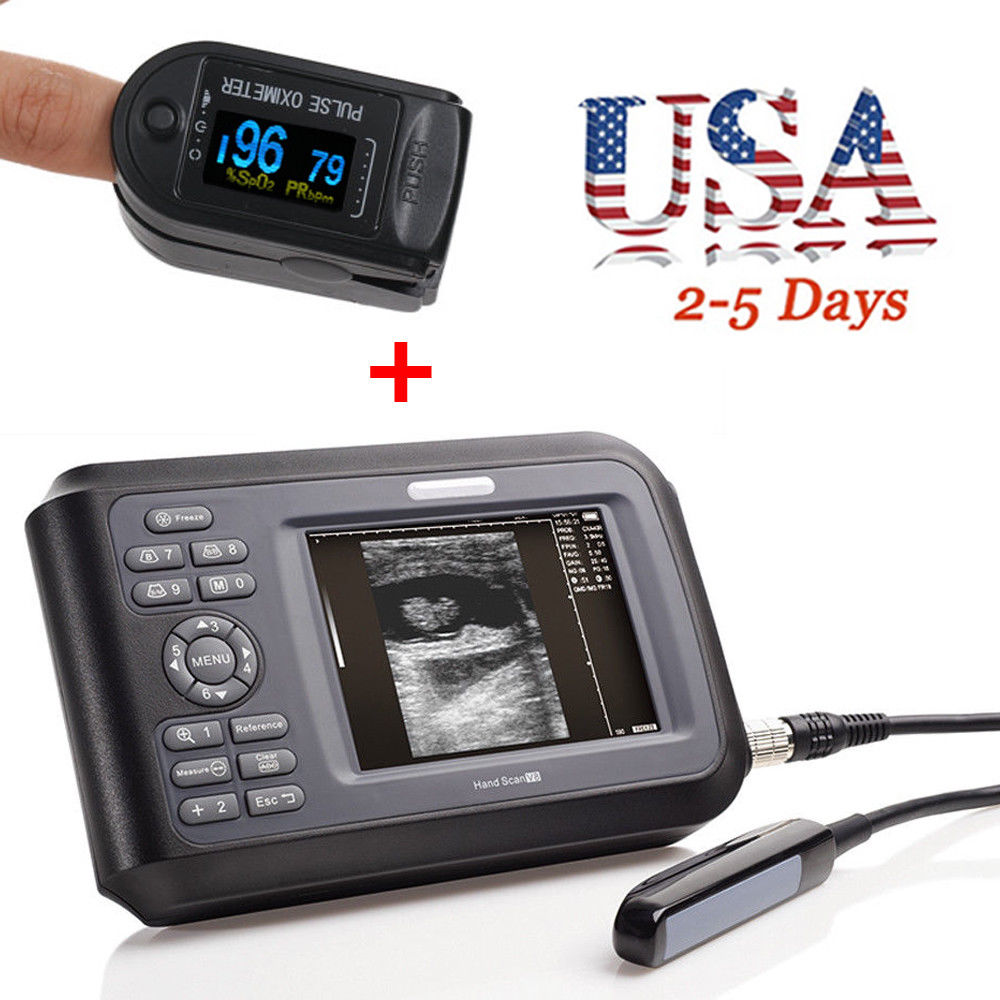 LCD Veterinary Laptop Machine Ultrasound scanner 7.5M Rectal Probe +Oximeter USA DIAGNOSTIC ULTRASOUND MACHINES FOR SALE