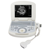 USA! Top 1 Ultrasound Machine Laptop Ultrasound Scanner Convex probe 3D Software 190891045898