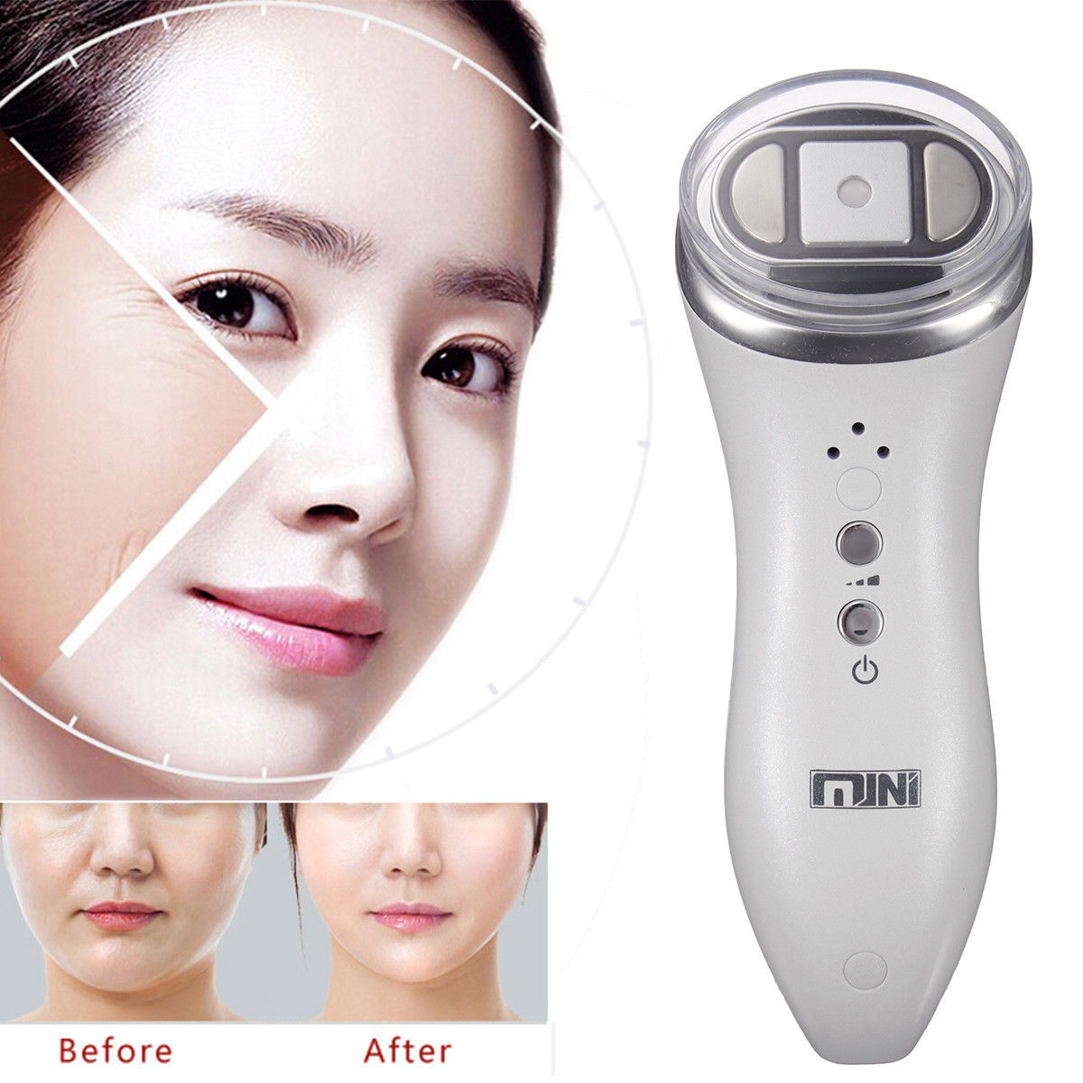 Mini HIFU High Intensity Focused Ultrasound Anti-Aging Wrinkle Removal with Gel 713965210024 DIAGNOSTIC ULTRASOUND MACHINES FOR SALE