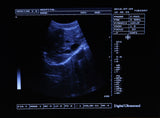 Portable High Image Full Portable Ultrasound Scanner Machine Linear probe 3D AA