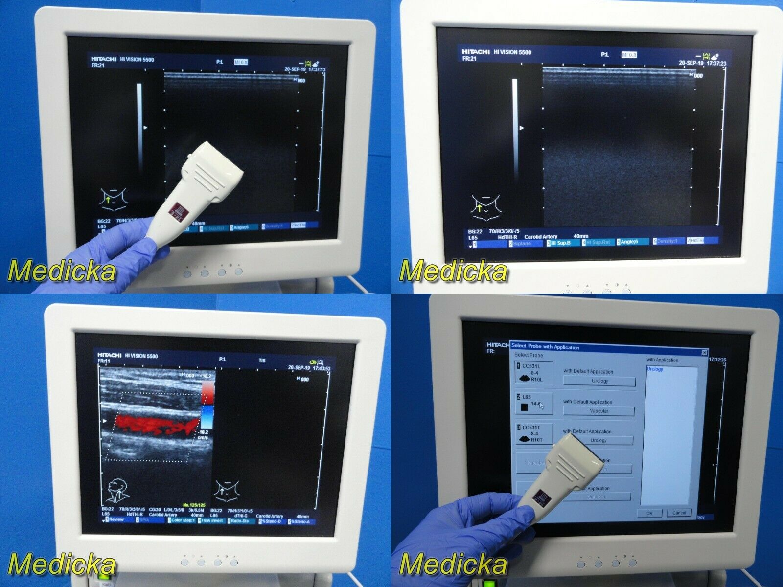 2010 Hitachi Hi-Vision 5500 EUB-5500 Flat Screen Ultrasound W/ 2X Probes~19256 DIAGNOSTIC ULTRASOUND MACHINES FOR SALE