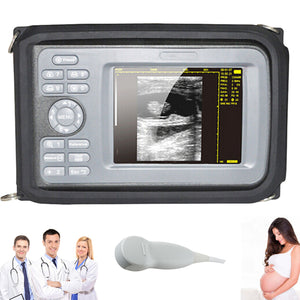 Digital Palm Smart Ultrasound Scanner +5Mhz Micro-convex Probe Human Cardiology 190891769312