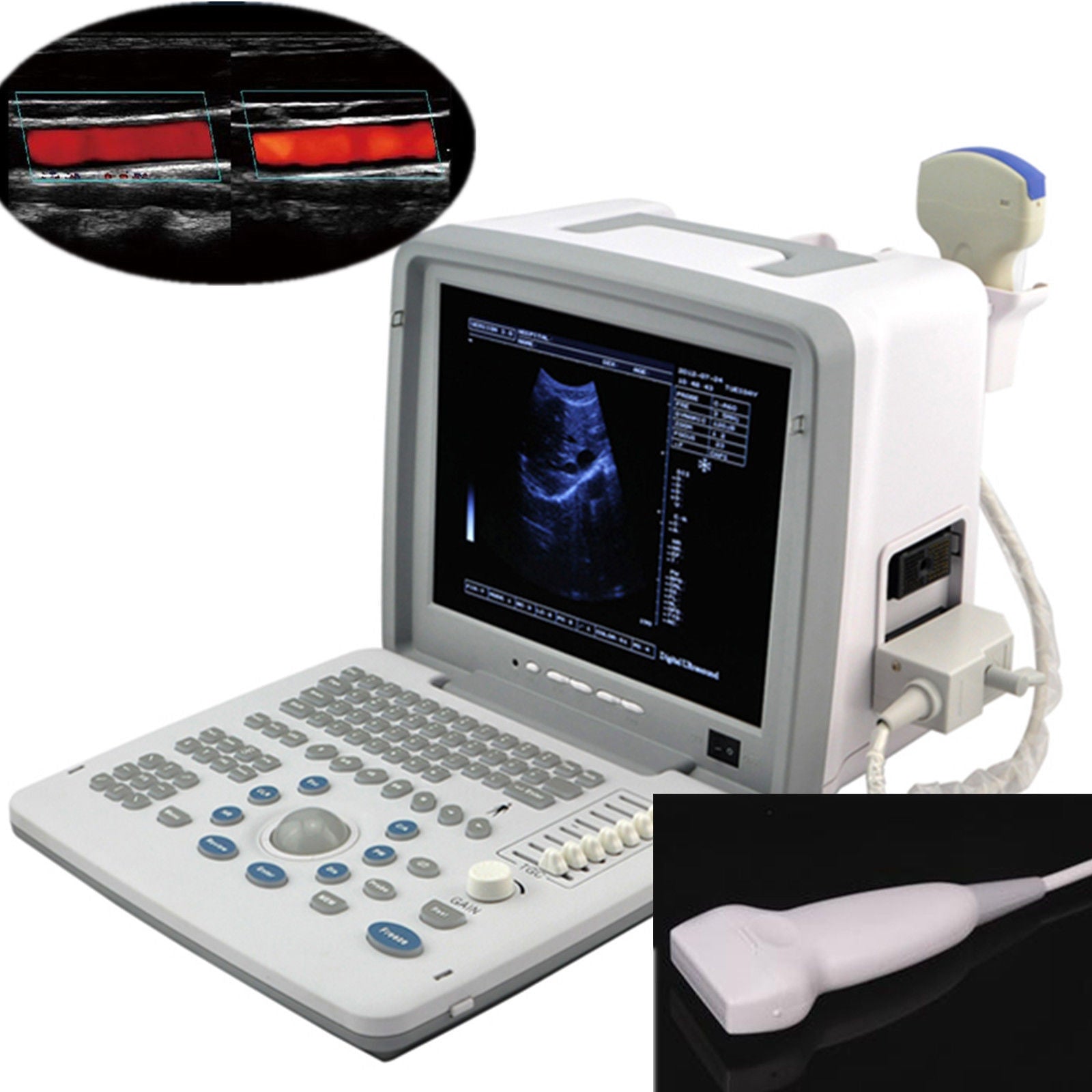 Portable Ultrasound Machine Scanner System 80R60 Convex linear probes / Optional DIAGNOSTIC ULTRASOUND MACHINES FOR SALE