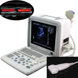 Portable Ultrasound Machine Scanner System 80R60 Convex linear probes / Optional