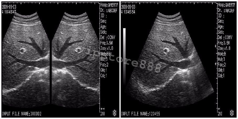 Digital Ultrasound Scanner Machine  +Convex +Vaginal + Linear 3 Probes/Sensor+3D DIAGNOSTIC ULTRASOUND MACHINES FOR SALE