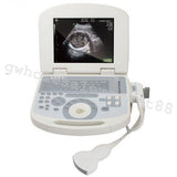 US Notebook Ultrasound Machine Scanner System Convex Probe +3D Software Portable 190891422491