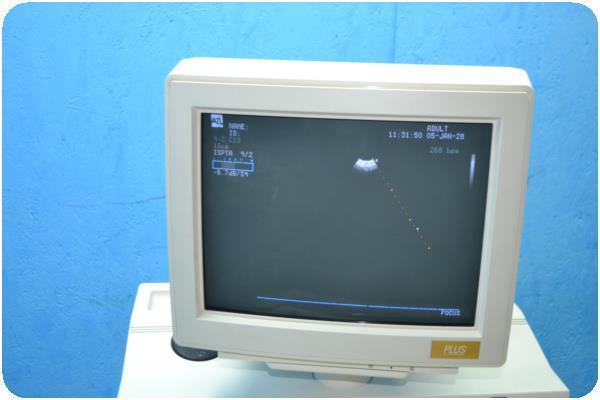 ATL ADVANCED TECHNOLOGY APOGEE 800 PLUS DIAGNOSTIC ULTRASOUND SYSTEM W PROBES @ DIAGNOSTIC ULTRASOUND MACHINES FOR SALE