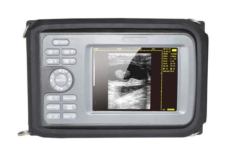 USA Veterinary Medical Digital PalmSmart Ultrasound Scanner Animal Rectal Probe 190891417367 DIAGNOSTIC ULTRASOUND MACHINES FOR SALE